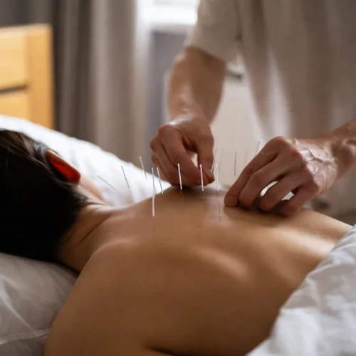 طب سوزنی در منزل مشهد